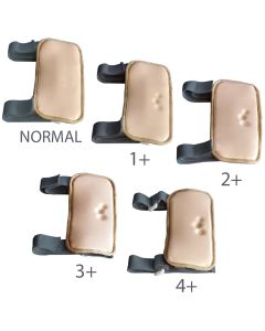 MW1 Pitting Edema Simulator