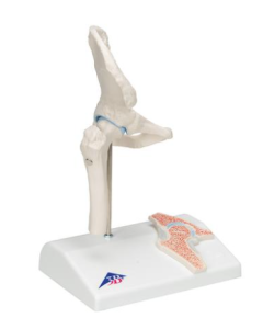 Mini Human Hip Joint Model with Cross Section