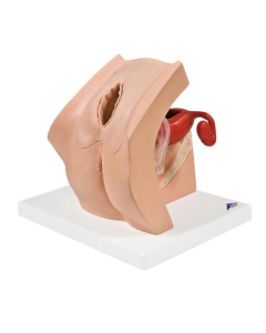 Model for Gynaecological Patient Education - Contraceptive & Pessary