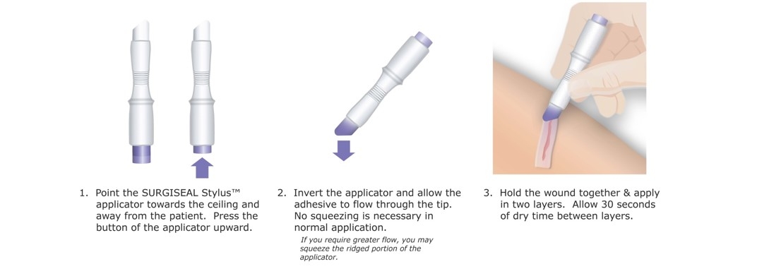 Surgiseal Stylus - Steps for Application